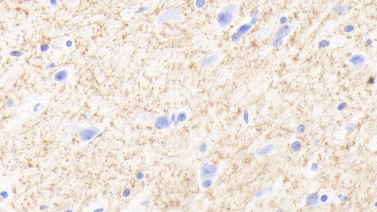 Polyclonal Antibody to 2',3'-Cyclic Nucleotide 3'-Phosphodiesterase (CNP)