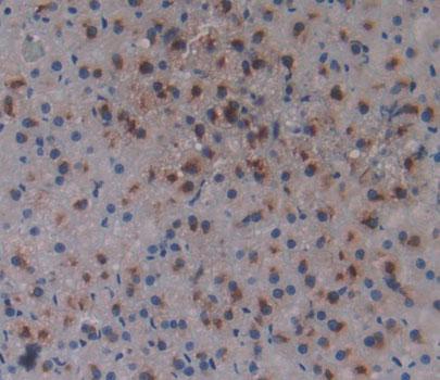 Polyclonal Antibody to Adrenocortical Dysplasia Homolog (ACD)