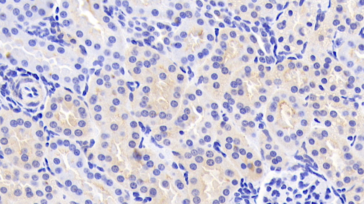 Polyclonal Antibody to Alpha Adducin (ADD1)