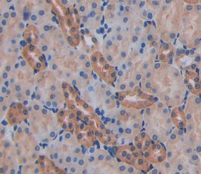 Polyclonal Antibody to Actin Filament Associated Protein 1 (AFAP1)