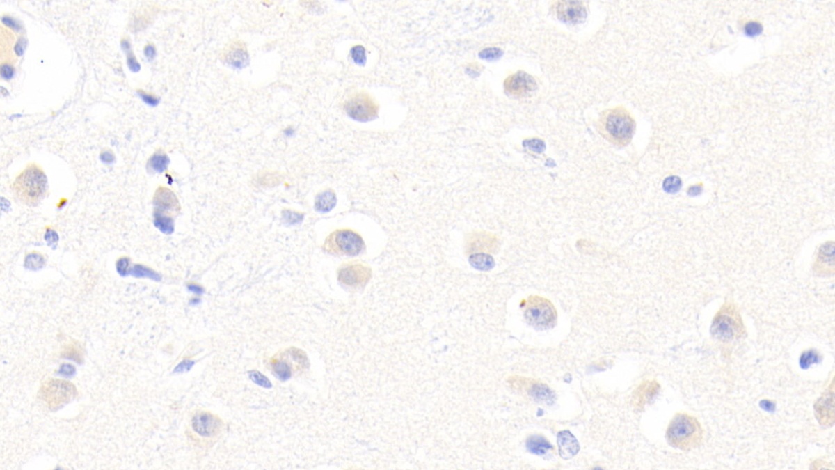 Polyclonal Antibody to Afamin (AFM)