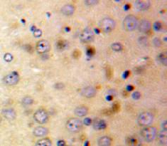 Polyclonal Antibody to Afamin (AFM)