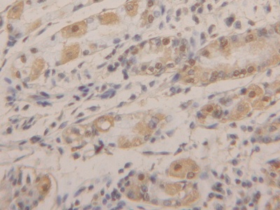 Polyclonal Antibody to Anterior Gradient 2 (AGR2)