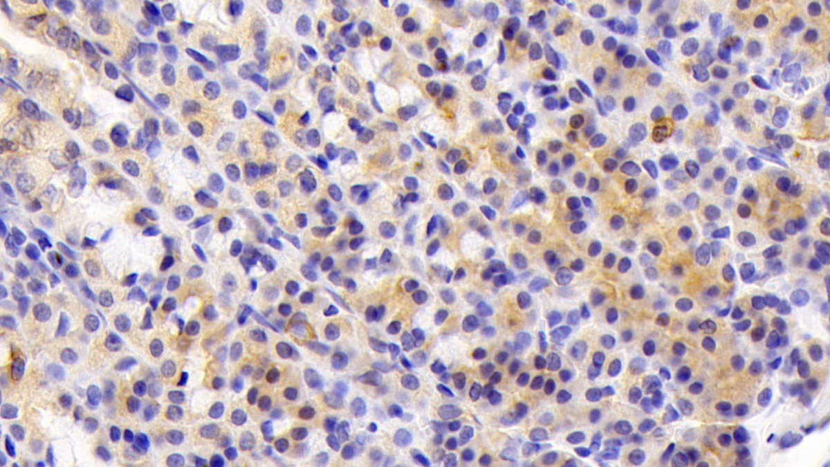 Polyclonal Antibody to Anterior Gradient 2 (AGR2)