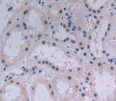 Polyclonal Antibody to Activating Transcription Factor 3 (ATF3)