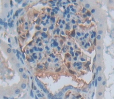 Polyclonal Antibody to Aurora Kinase C (AURKC)