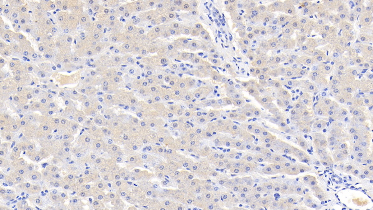 Polyclonal Antibody to Antithrombin (AT)