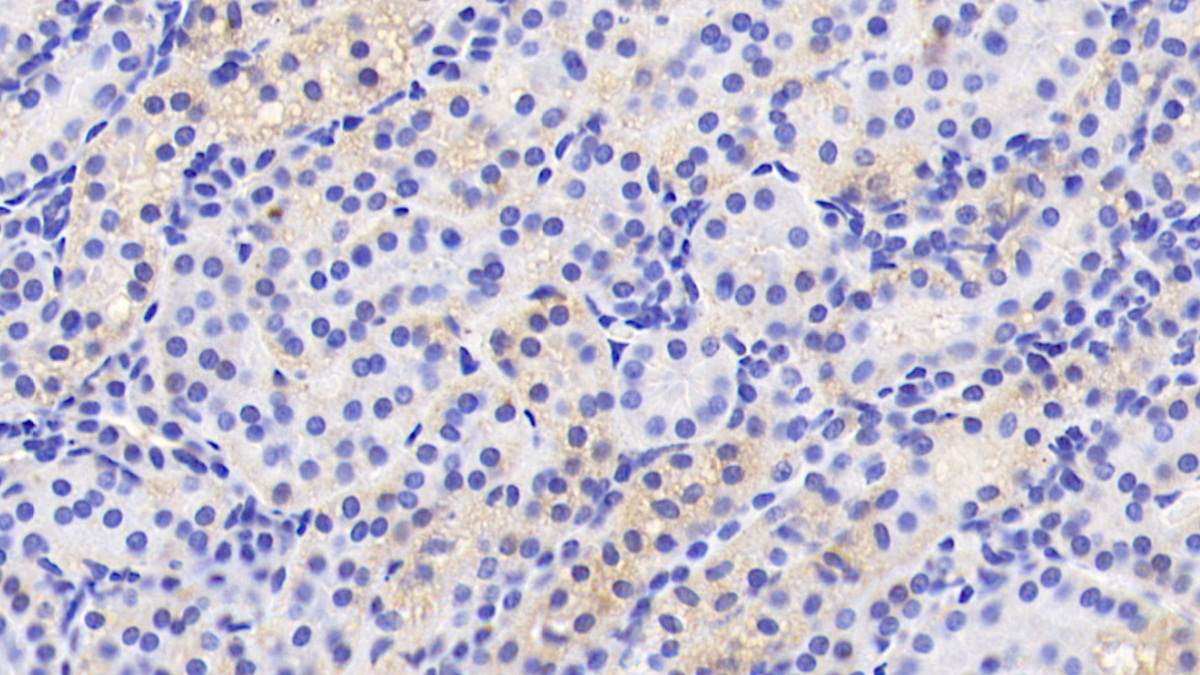 Polyclonal Antibody to Antithrombin (AT)