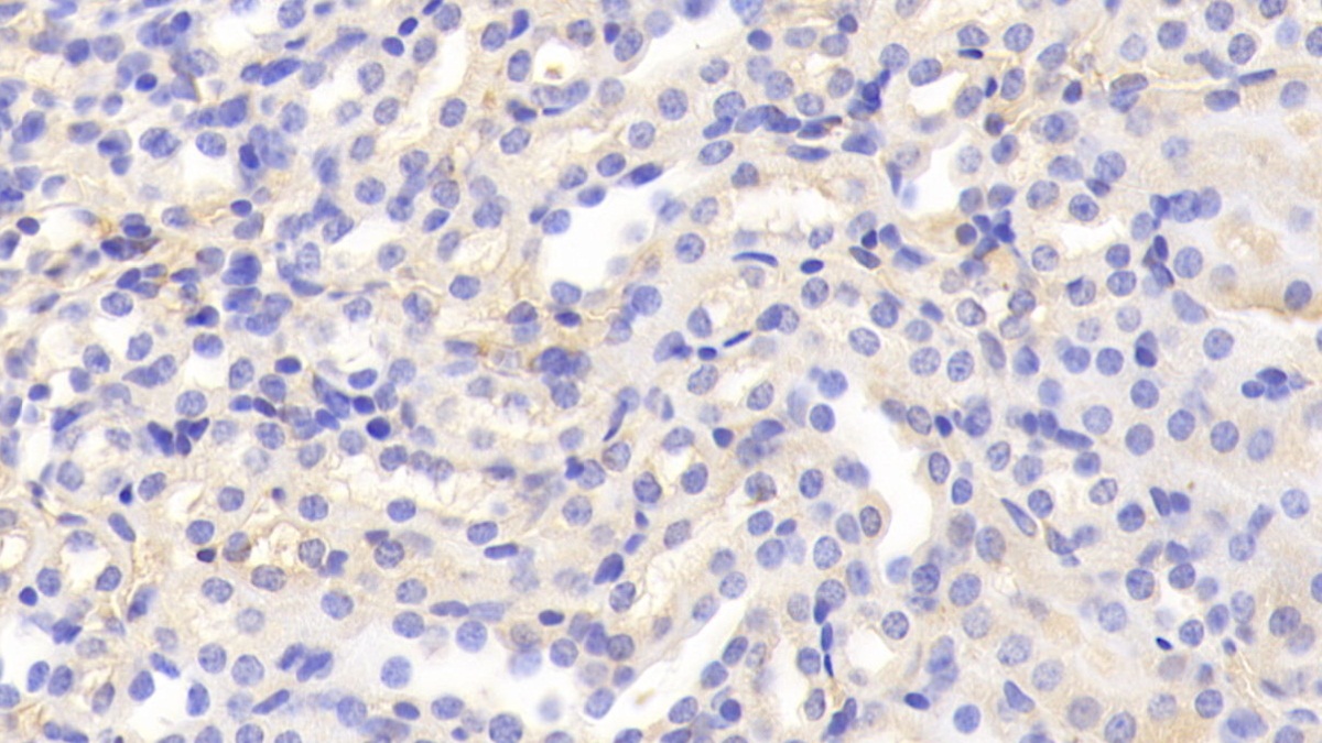 Polyclonal Antibody to Antithrombin (AT)