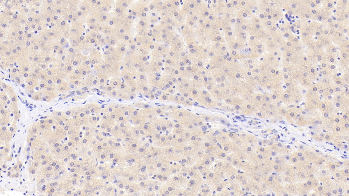 Polyclonal Antibody to Ectonucleotide Pyrophosphatase/Phosphodiesterase 2 (ENPP2)