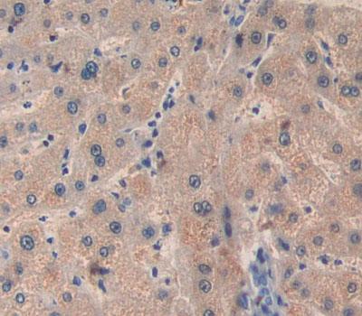 Polyclonal Antibody to B-Cell CLL/Lymphoma 10 (Bcl10)