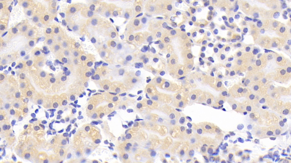 Polyclonal Antibody to B-Cell CLL/Lymphoma 10 (Bcl10)