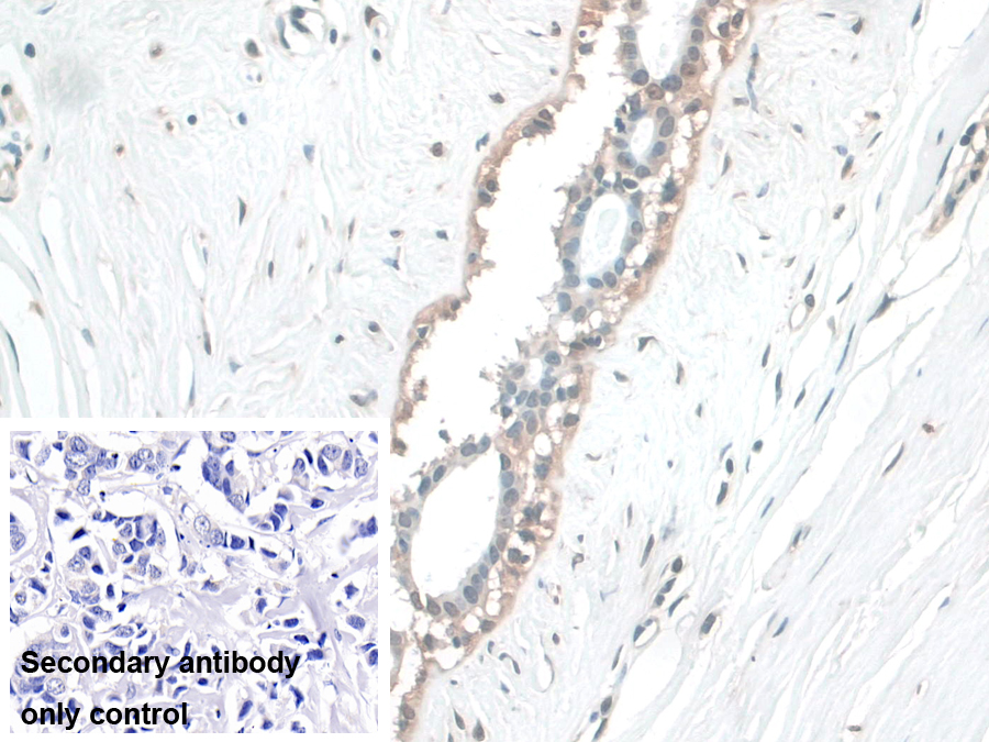 Polyclonal Antibody to Barrier To Autointegration Factor 1 (BANF1)