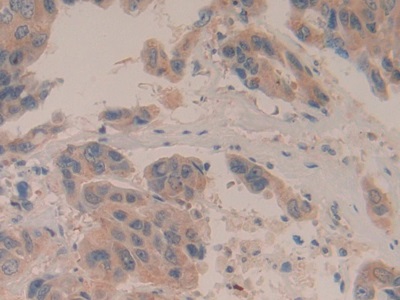 Polyclonal Antibody to Bcl2 Associated Death Promoter (BAD)