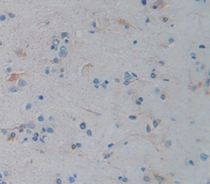 Polyclonal Antibody to Lipase, Bile Salt Dependent (BSDL)