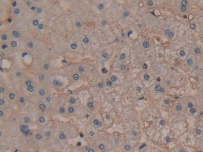 Polyclonal Antibody to Annexin A6 (ANXA6)