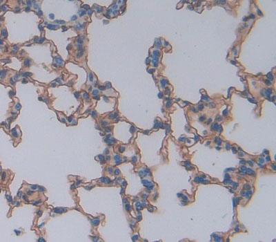 Polyclonal Antibody to C-Src Tyrosine Kinase (CSK)