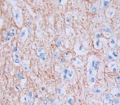 Polyclonal Antibody to Calneuron 1 (CALN1)