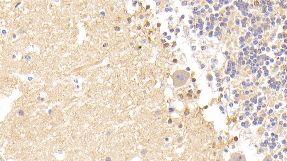 Polyclonal Antibody to Calcium Modulating Ligand (CAMLG)