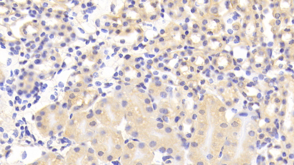 Polyclonal Antibody to Calcium Modulating Ligand (CAMLG)