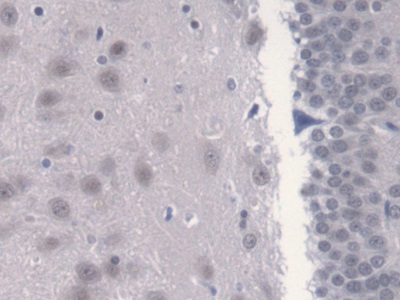 Polyclonal Antibody to Calcium Modulating Ligand (CAMLG)