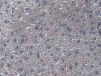 Polyclonal Antibody to Calcium Activated Nucleotidase 1 (CANT1)