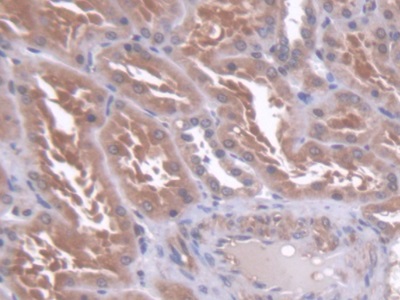 Polyclonal Antibody to Core Binding Factor Beta Subunit (CBFb)