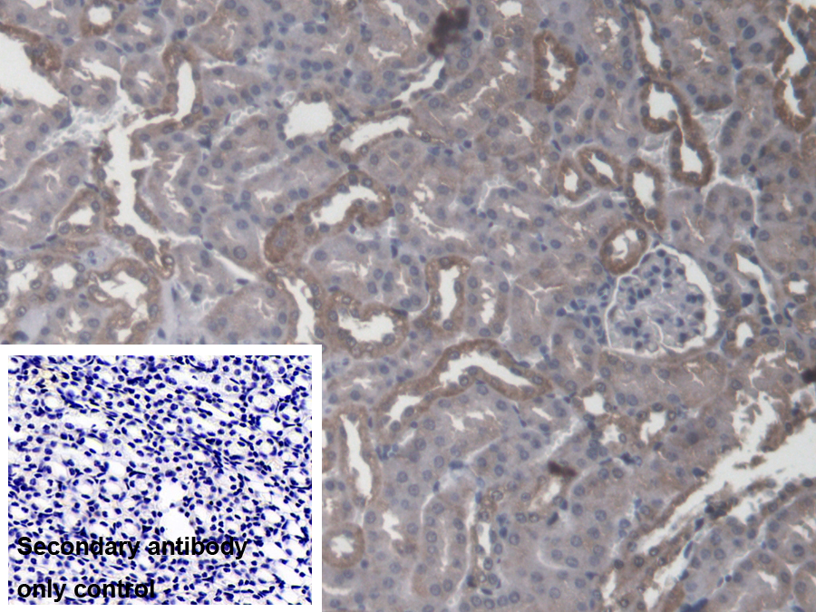 Polyclonal Antibody to Core Binding Factor Beta Subunit (CBFb)