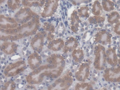 Polyclonal Antibody to Chibby Homolog 1 (CBY1)