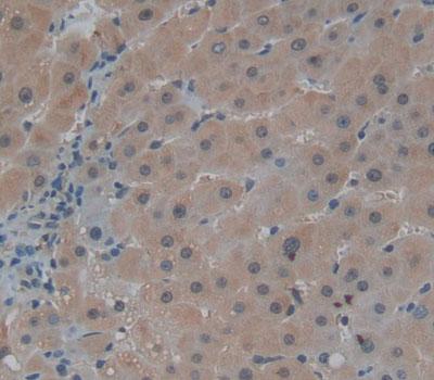 Polyclonal Antibody to Centrosomal Protein 110kDa (CEP110)