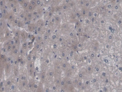 Polyclonal Antibody to Calcium Binding Protein P22 (CHP)