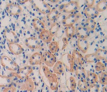 Polyclonal Antibody to Cytokine Inducible SH2 Containing Protein (CISH)