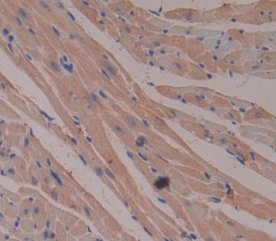 Polyclonal Antibody to Creatine Kinase, Mitochondrial 2, Sarcomeric (CKMT2)