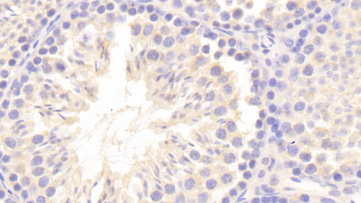 Polyclonal Antibody to Carnitine Acetyltransferase (CRAT)