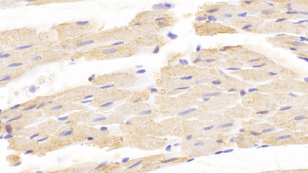 Polyclonal Antibody to Corticotropin Releasing Hormone Binding Protein (CRHBP)