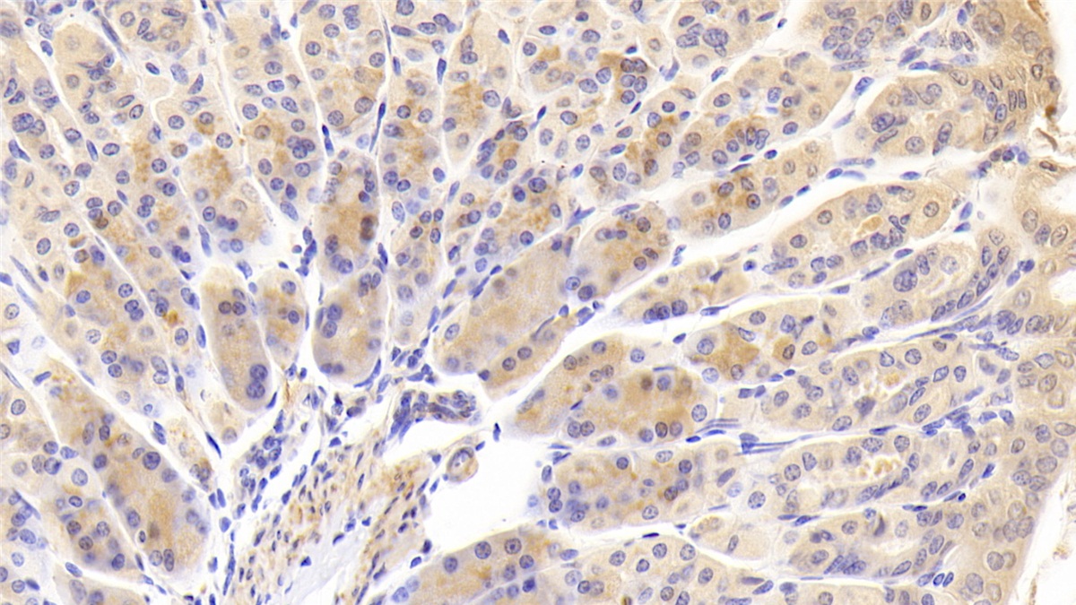 Polyclonal Antibody to Carnitine-O-Octanoyltransferase (CORT)