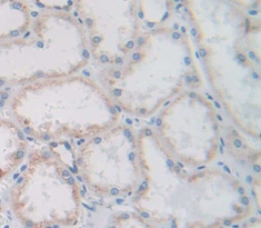 Polyclonal Antibody to Cubilin (CUBN)