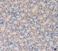 Polyclonal Antibody to Cubilin (CUBN)