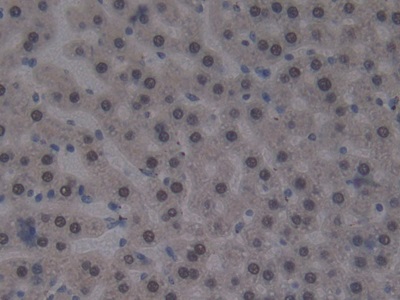 Polyclonal Antibody to Cubilin (CUBN)