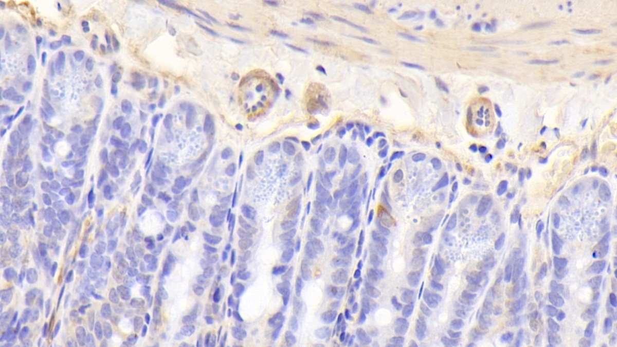 Polyclonal Antibody to Calcitonin Receptor (CTR)