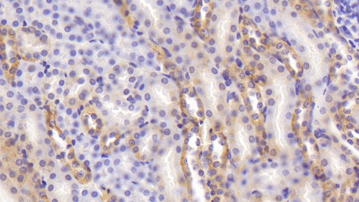 Polyclonal Antibody to Calcium Sensing Receptor (CASR)