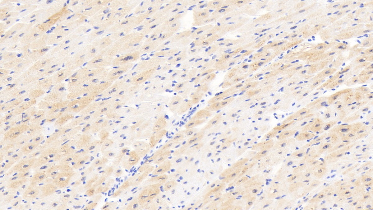 Polyclonal Antibody to Carnitine Palmitoyltransferase 2, Mitochondrial (CPT2)