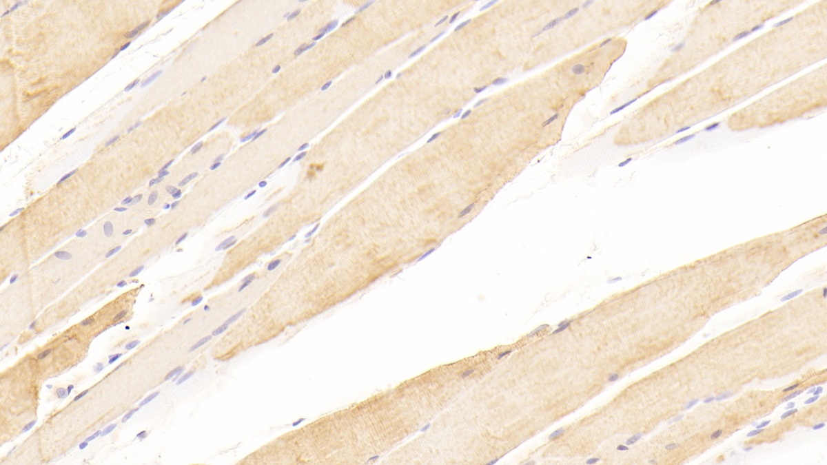 Polyclonal Antibody to Carnitine Palmitoyltransferase 2, Mitochondrial (CPT2)