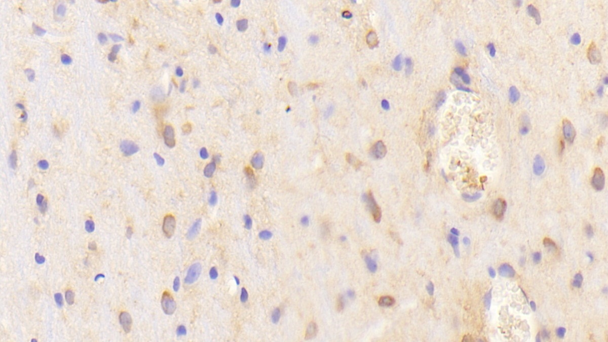 Polyclonal Antibody to Chimerin 2 (CHN2)