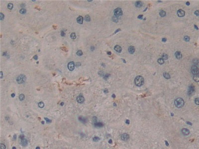 Polyclonal Antibody to Cylindromatosis (CYLD)