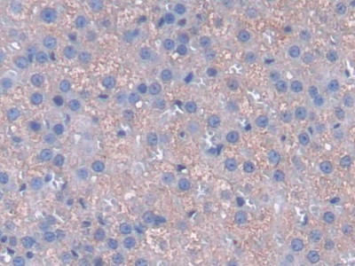 Polyclonal Antibody to Cytoglobin (CYGB)