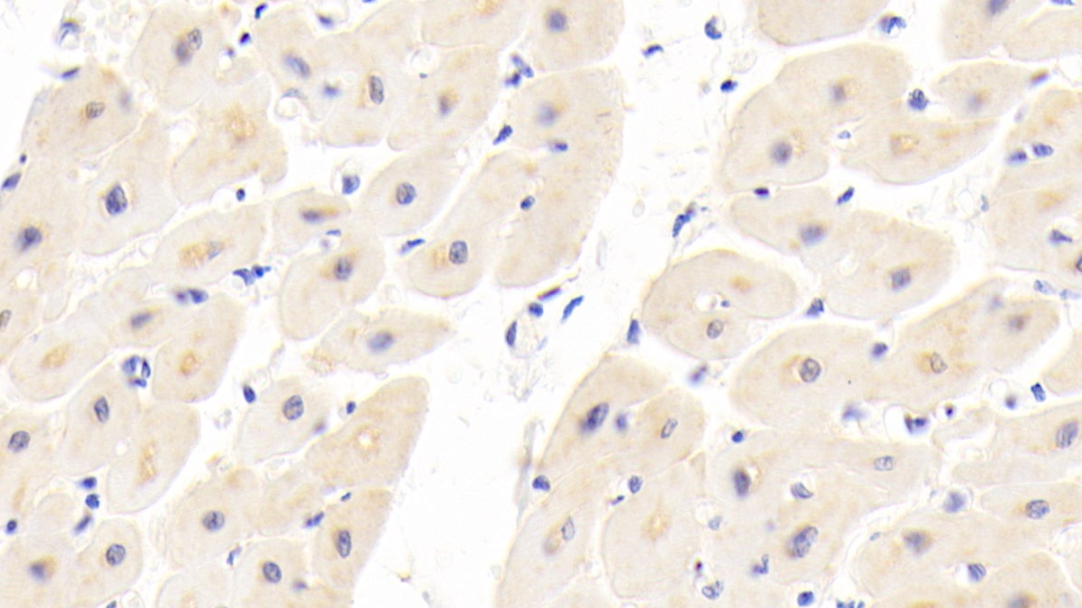 Polyclonal Antibody to Dishevelled Associated Activator Of Morphogenesis 1 (DAAM1)