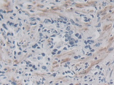 Polyclonal Antibody to Drebrin 1 (DBN1)