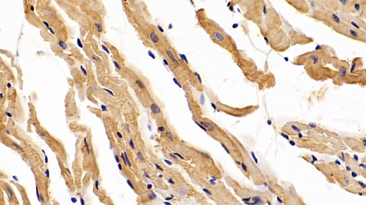 Polyclonal Antibody to Dermatopontin (DPT)