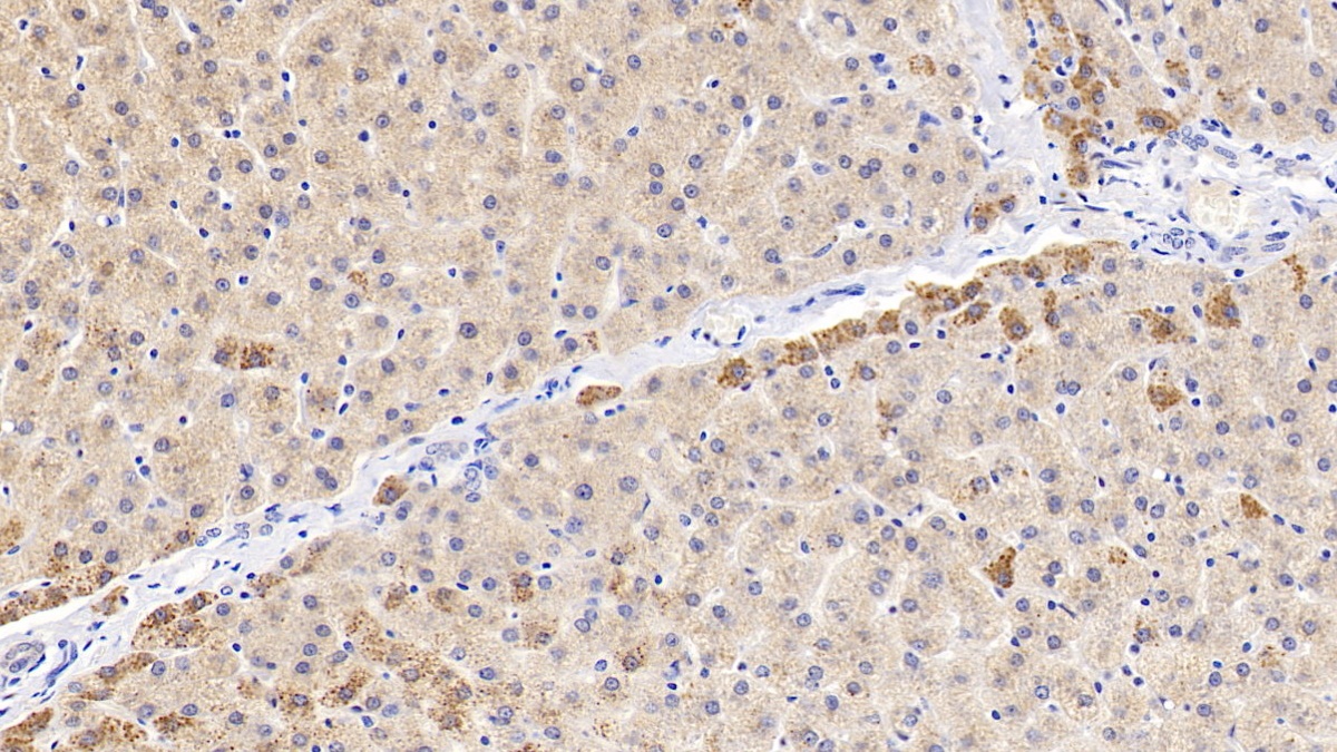 Polyclonal Antibody to Dymeclin (DYM)